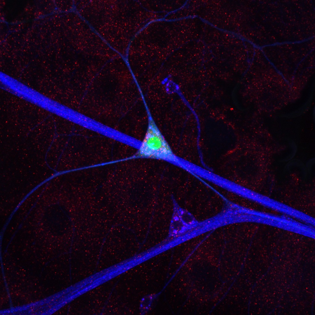 Image of fruit fly neuron taken by Kayla Gjelsvik