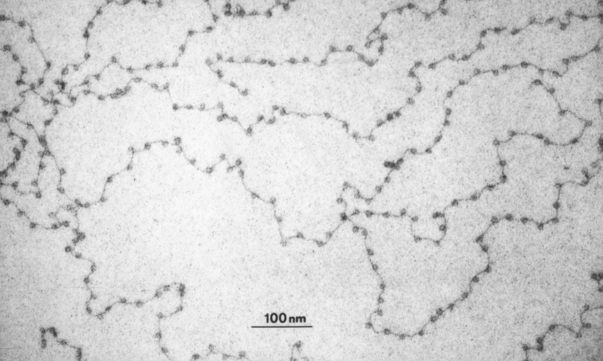 Electron micrograph of nucleosomes