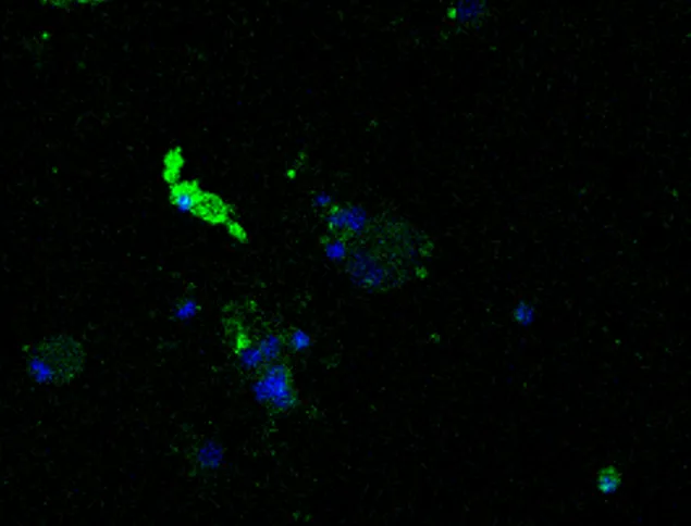 The blue specks are dorsal root ganglion neuron cells acquired from the lab of Derek Molliver, associate professor of neuroscien