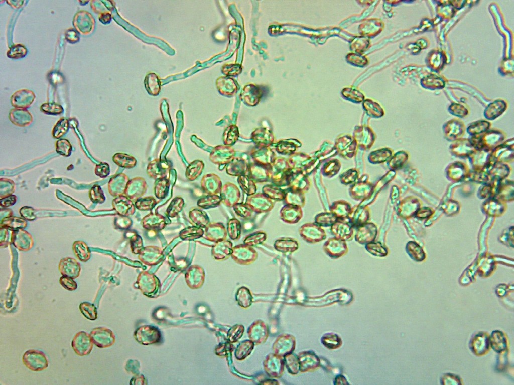 Blight-tolerant chestnut pollen as seen through a microscope