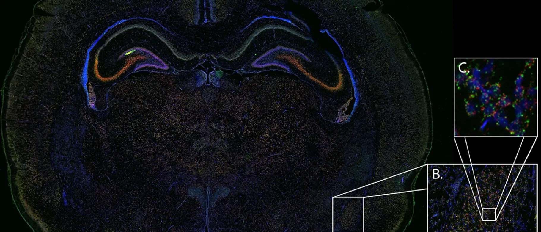 The Burman Collaborative used cutting-edge “RNAscope” technology to look for changes in the neonatal brain caused by pain.