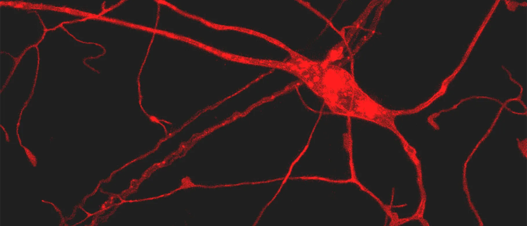 A nociceptor (pain-perceiving) neuron in a living fly. Photo by Courtney Brann ’18.