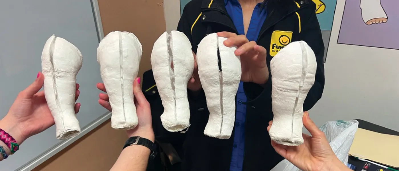 A row of five medical casts