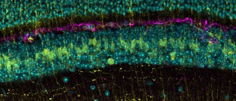 A microscope image of a mouse retina