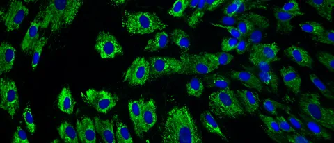 unaltered fibroblasts